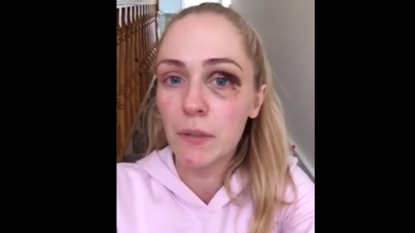 Brave mum speaks out about domestic violence in emotional Facebook video