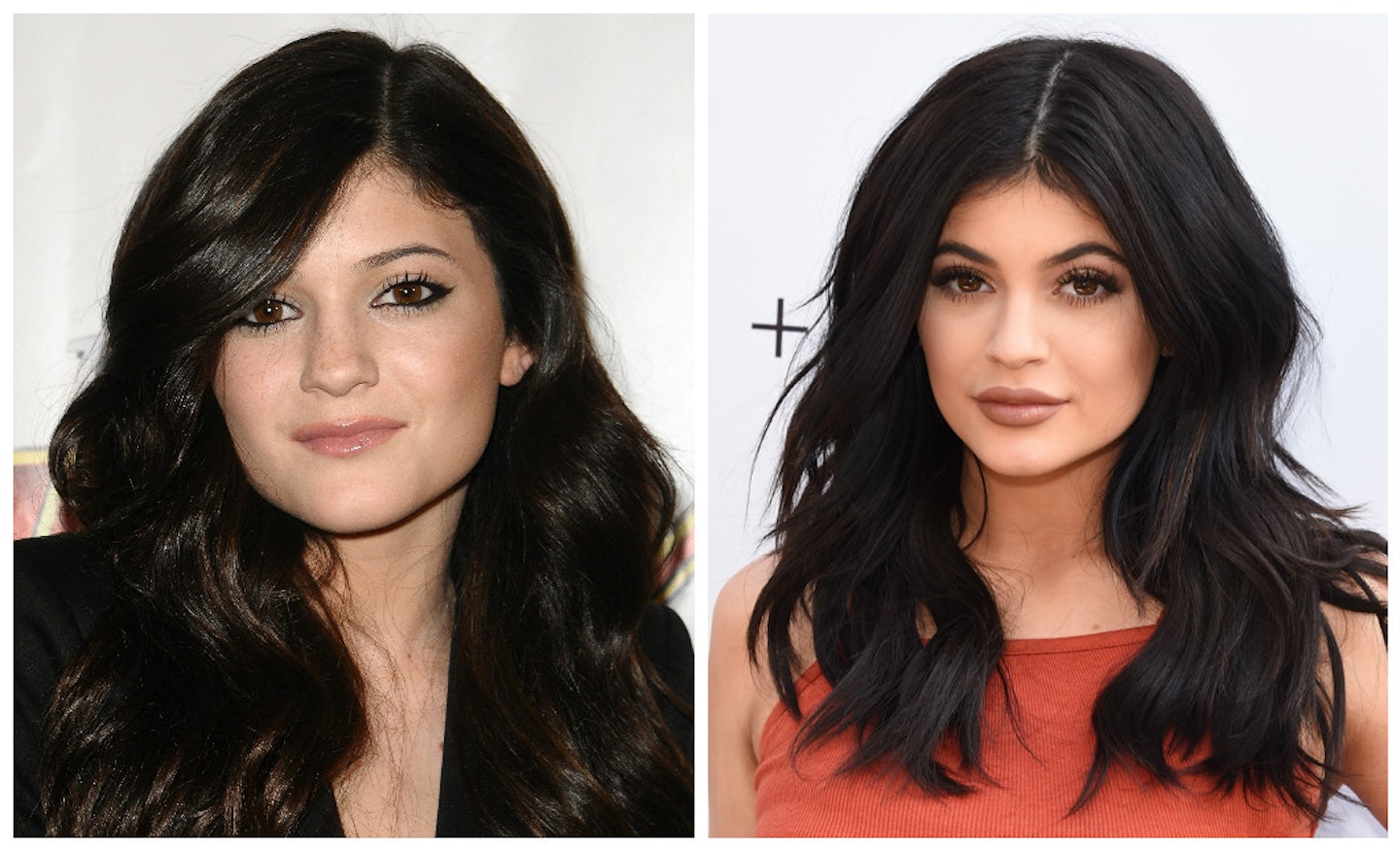 Kylie before and after lip fillers via Getty