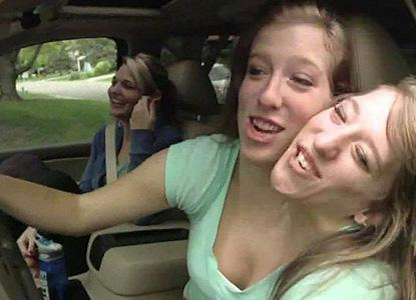 Amazing story of conjoined twins Abigail and Brittany Hensel