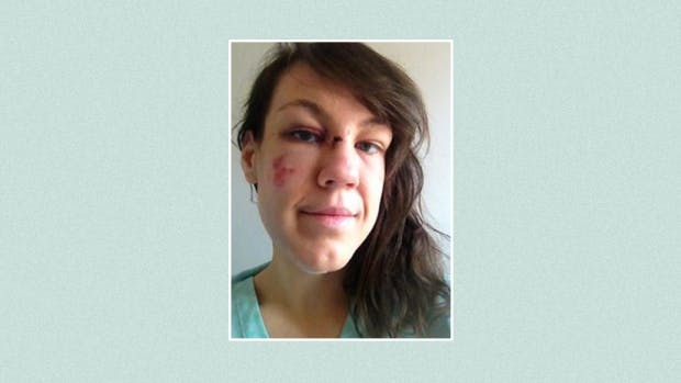 When Jeanne Marie Ryan Was Groped And Assaulted In A Club She Posted This #NoMakeUp Selfie Life Grazia photo