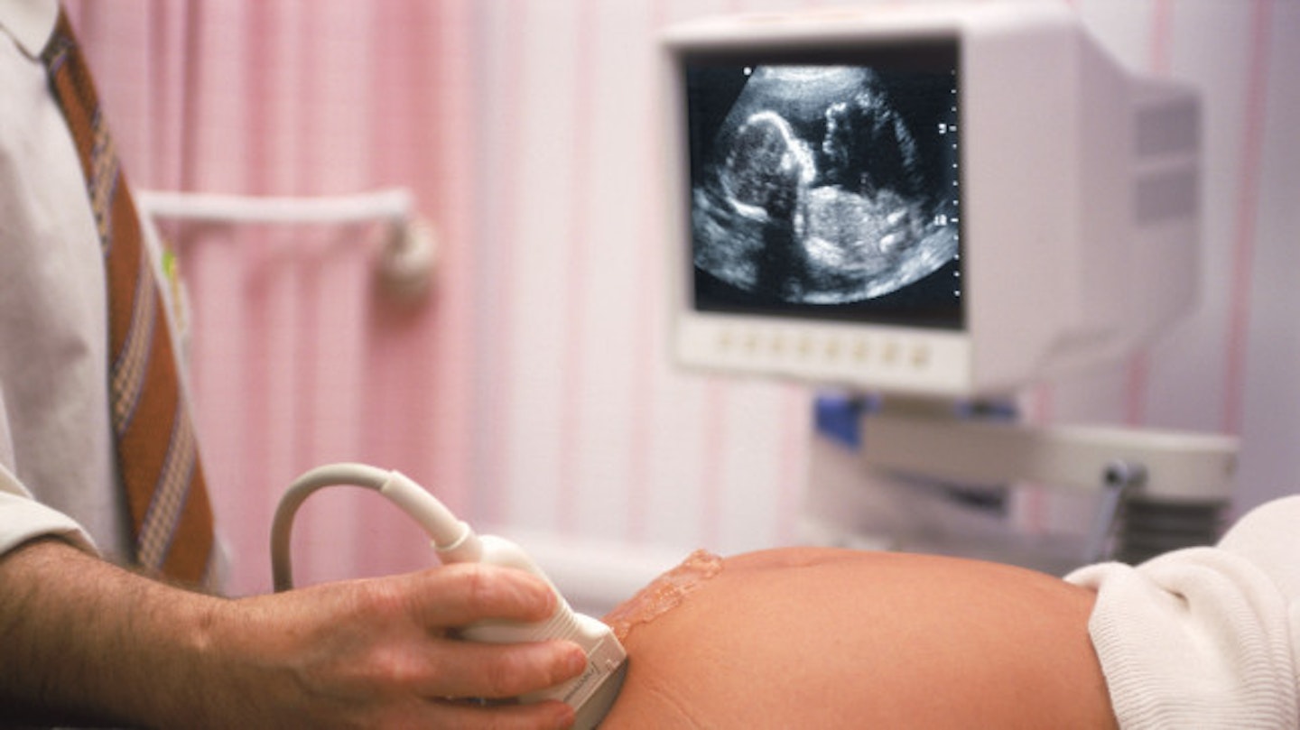 Teri was pressured to have an abortion - but she refused
