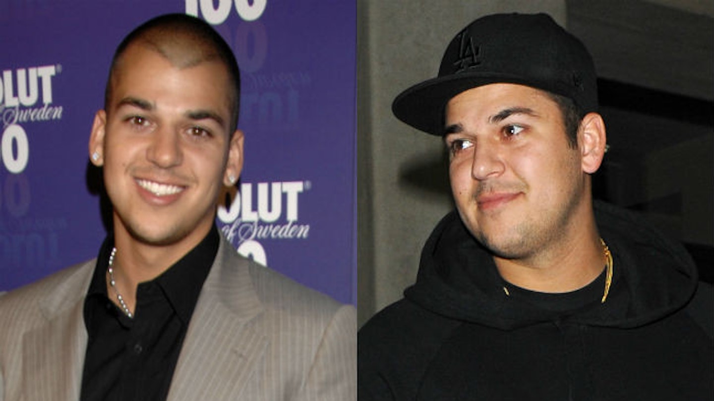 rob kardashian before and after weight loss fat