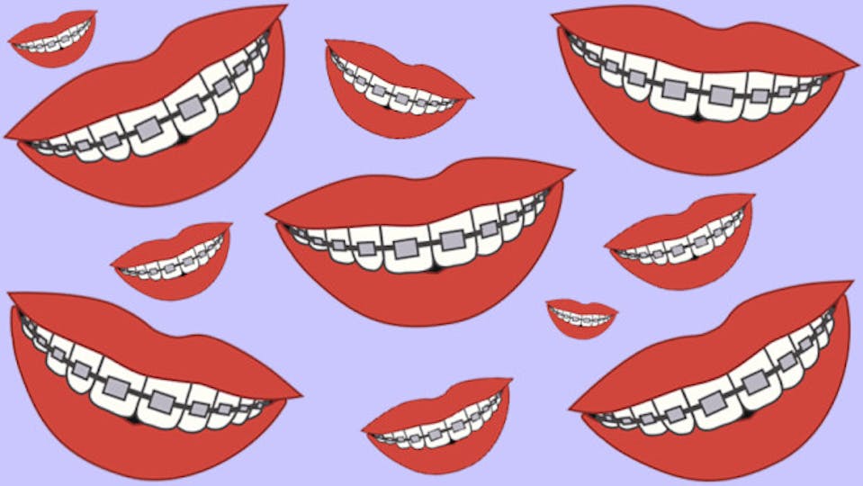 The Reality Of Dating When You've Got Adult Braces | Grazia