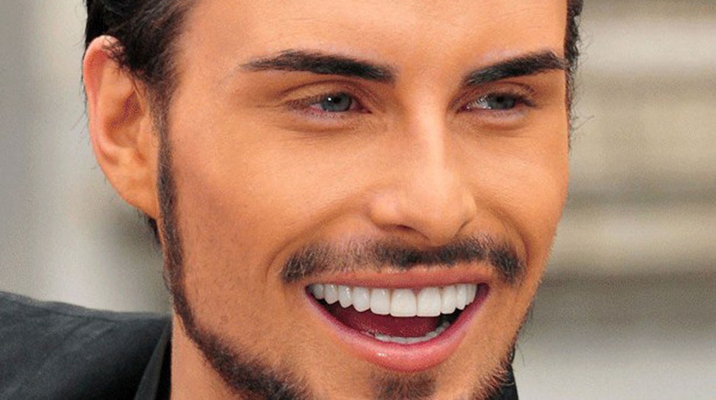 Rylan-Clark-teeth-after-picture