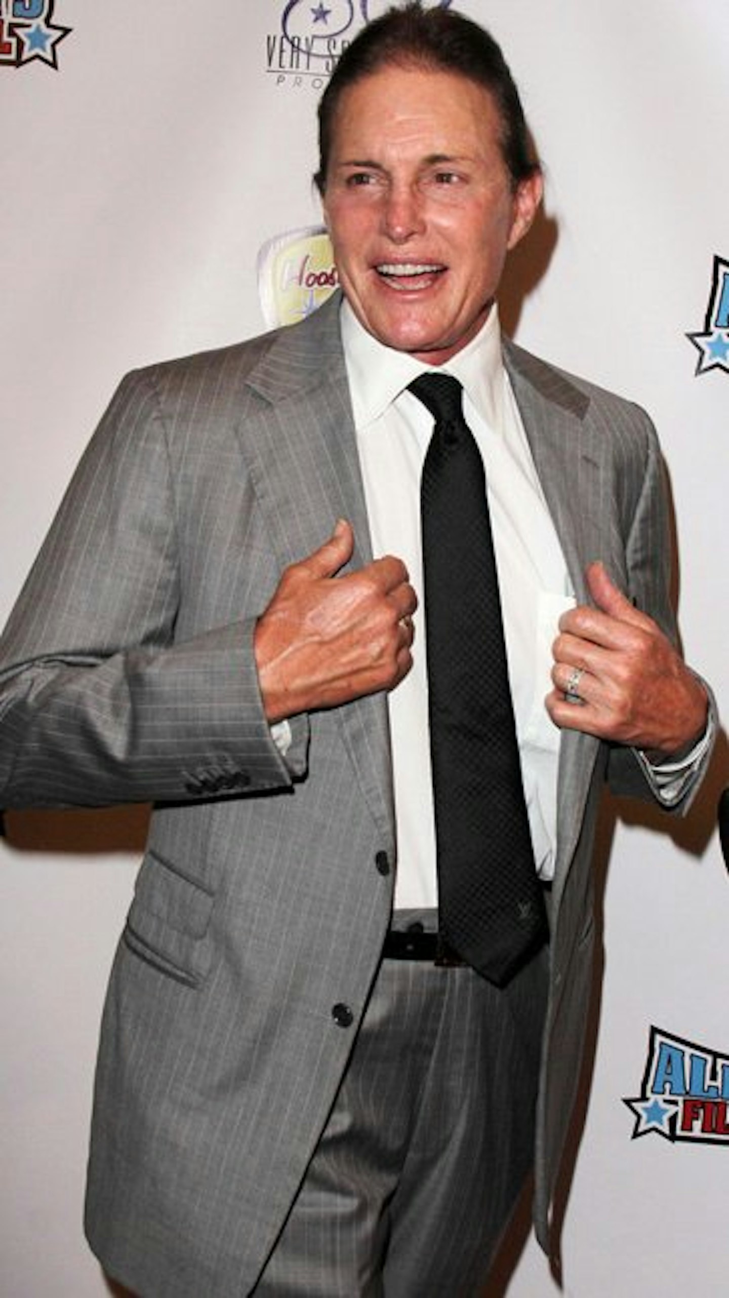 Bruce underwent a laryngeal shave earlier this year.