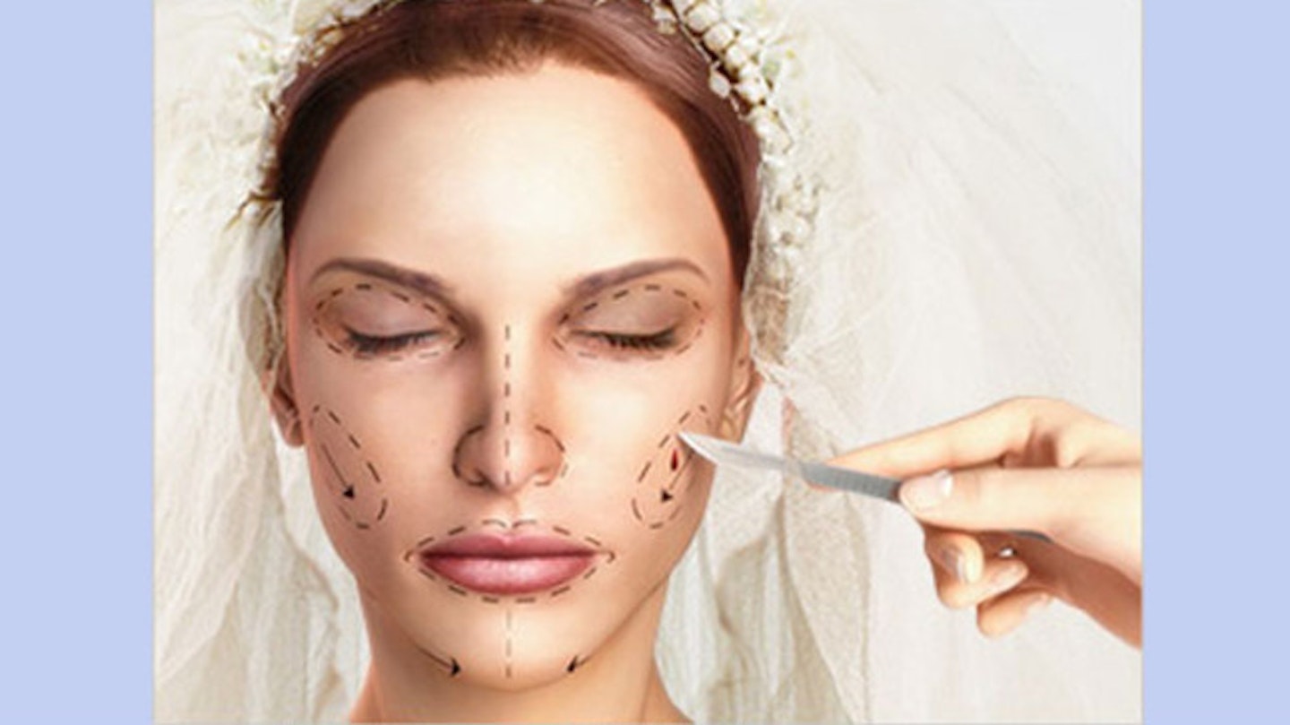 Forget Botox: Here’s why you should look like YOU on your wedding day