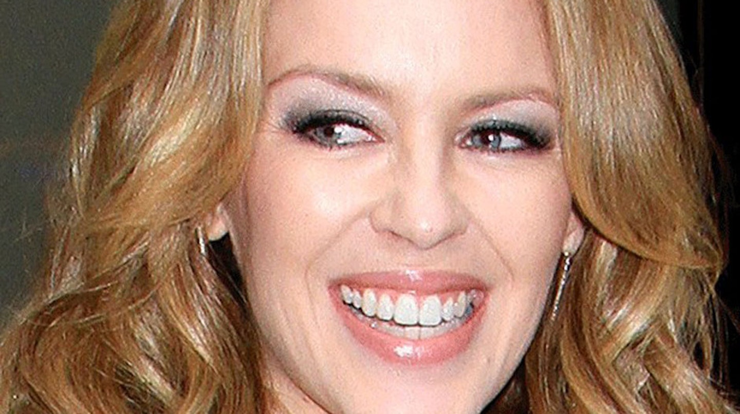 Kylie-Minogue-veneers-teeth-after