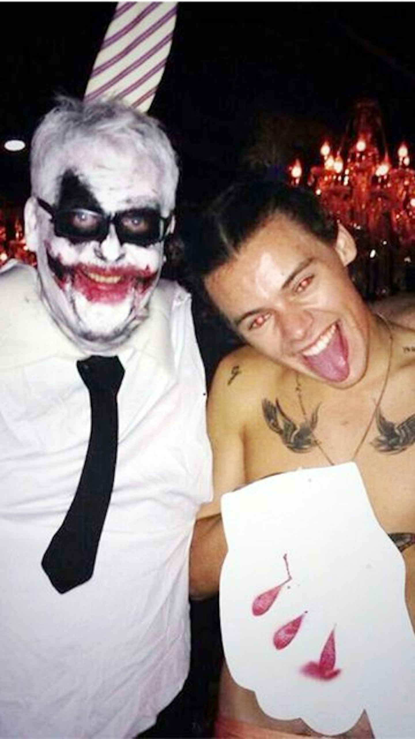 harry2