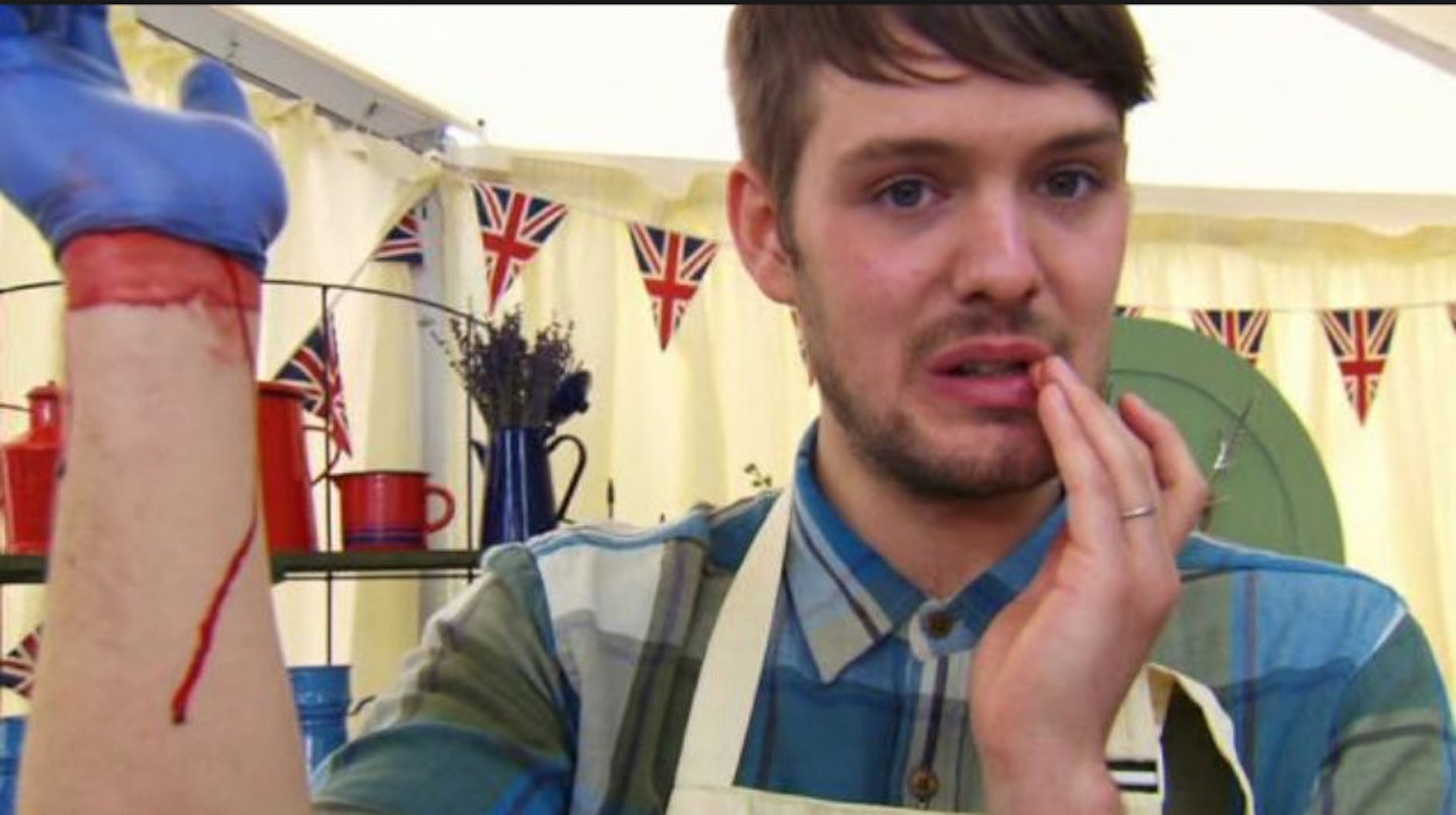 gbbo John Whaite bleeding