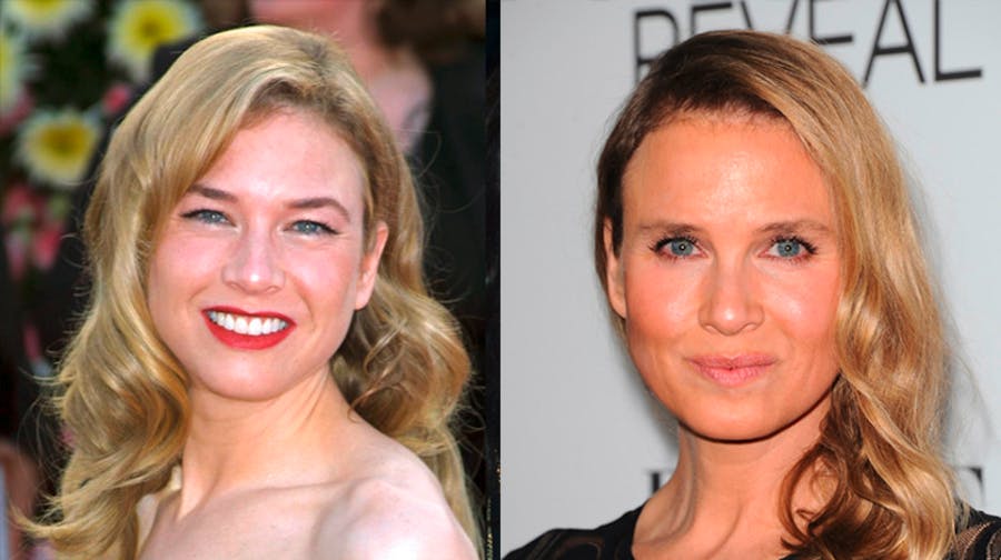 Renee Zellweger Opens Up About Her Huge Face Changes I M Finally Happy Celebrity Heat Renee Zellweger Opens Up About Her Huge Face Changes I M Finally Happy Celebrity Heat