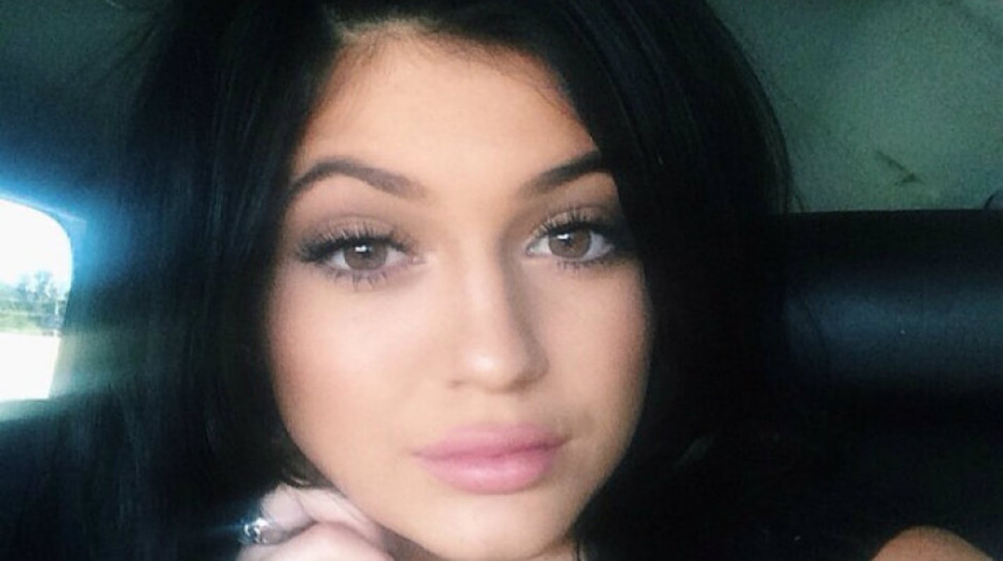 kylie-jenner-after-surgery8
