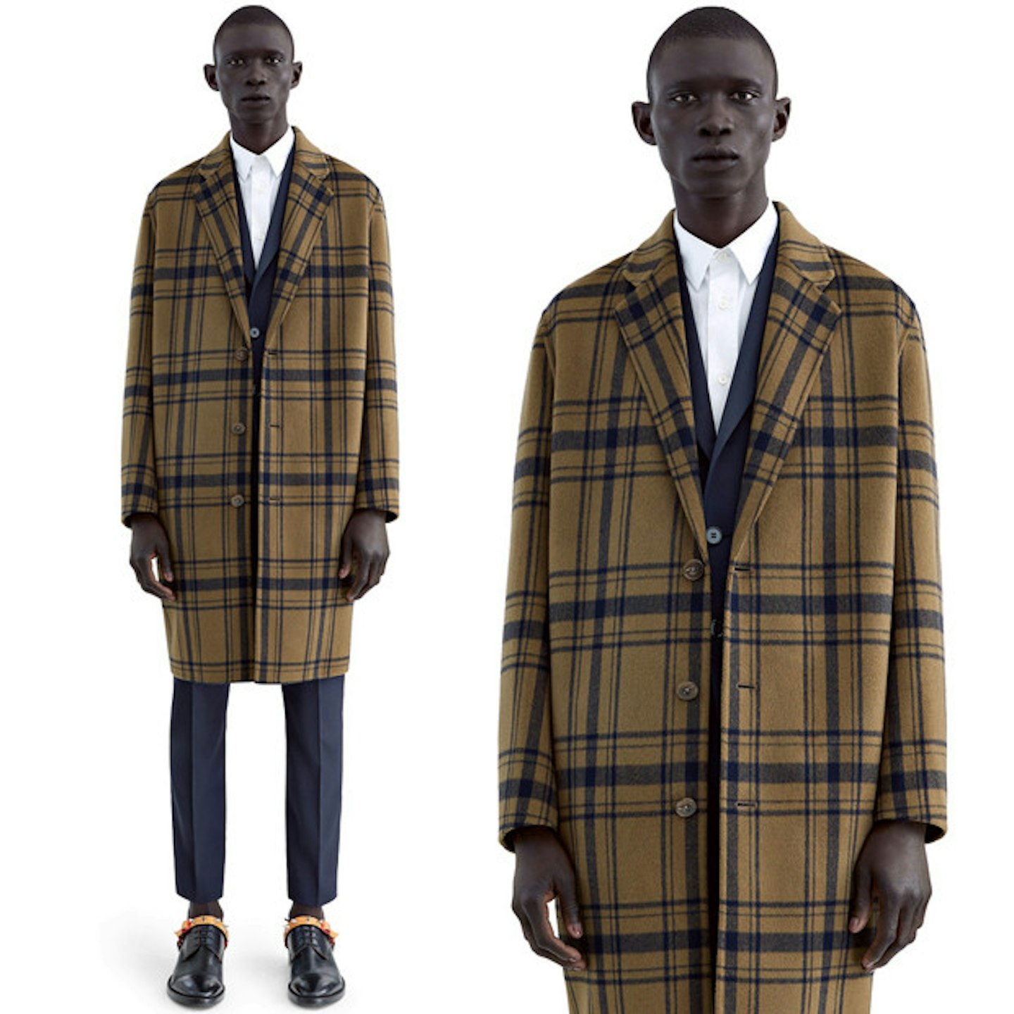acne