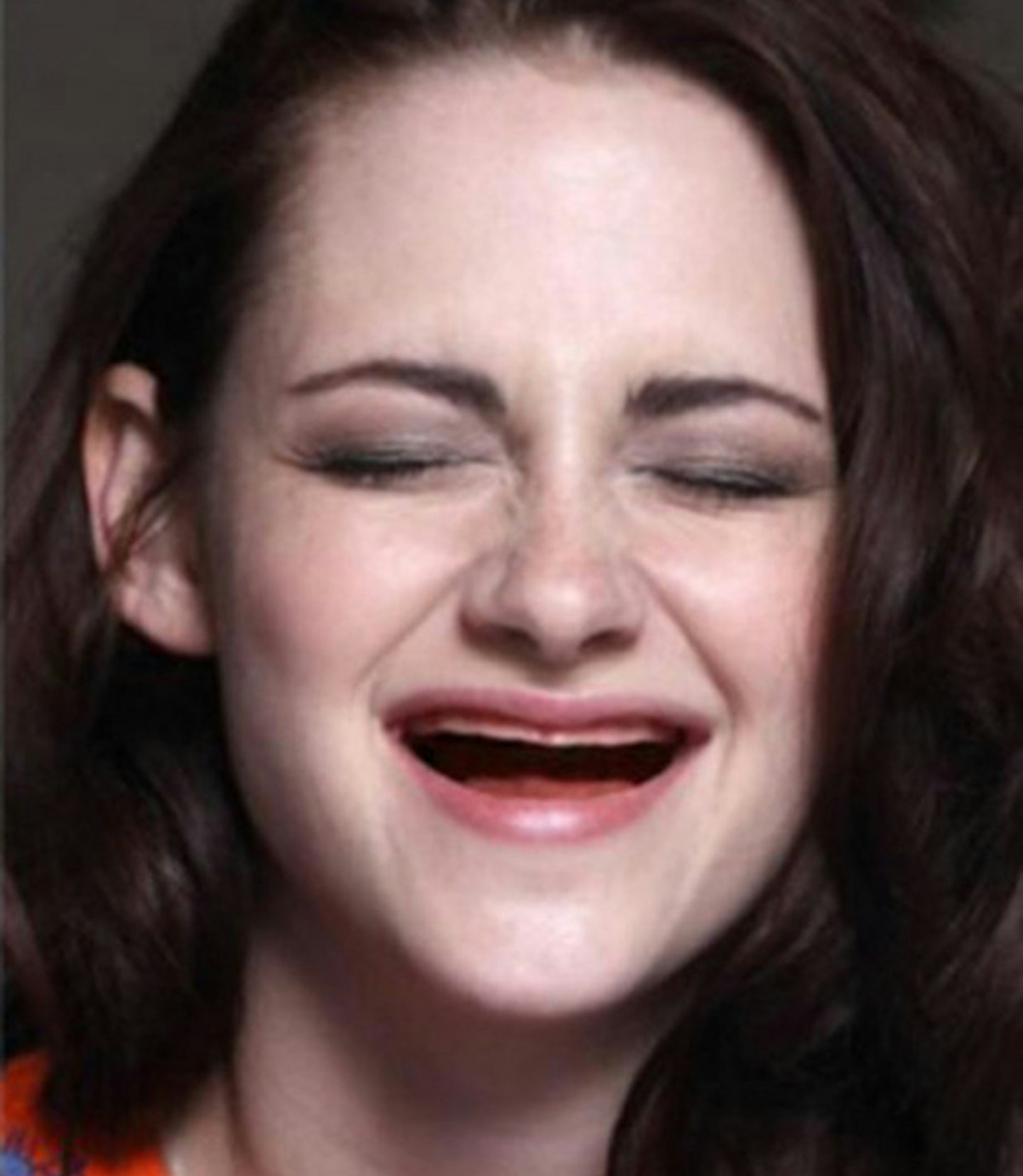 celebrities with no teeth