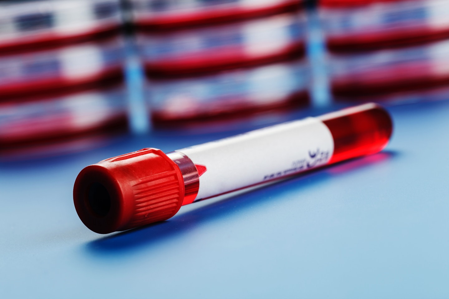 The new non-invasive test examines the foetus' DNA through the mother's blood sample 