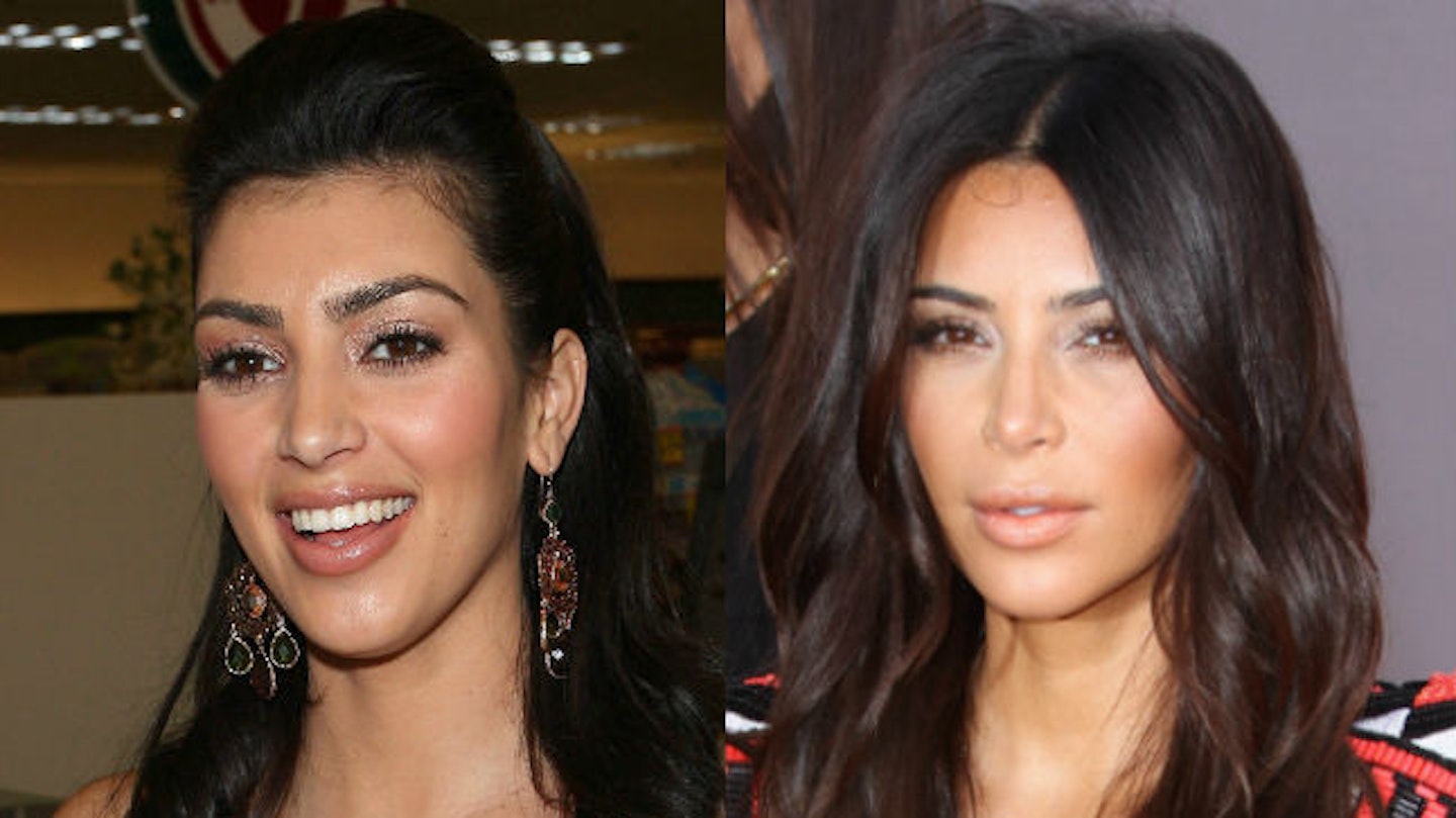 Kim kardashian surgery before and after