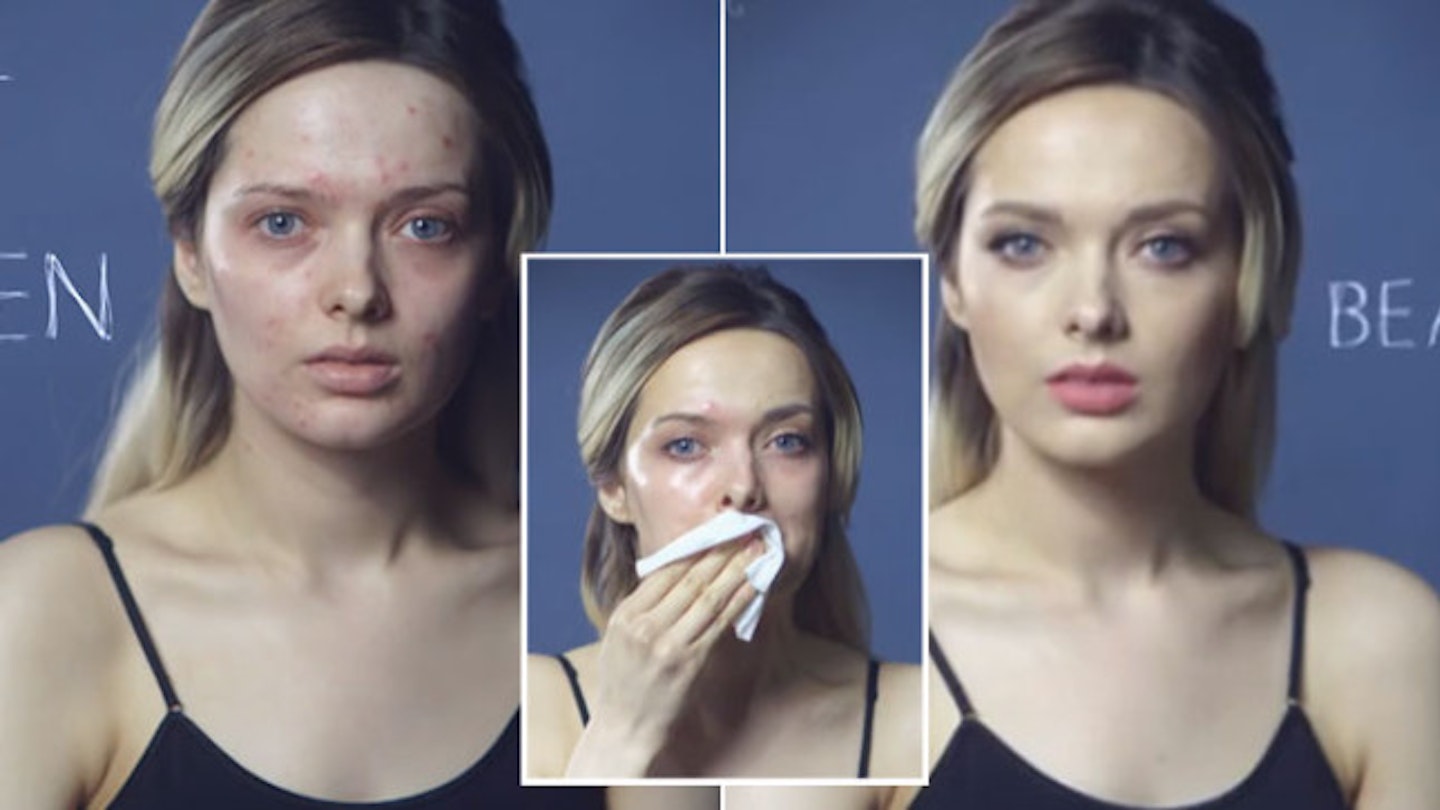 WATCH: Brave woman’s acne video sends powerful message to online bullies