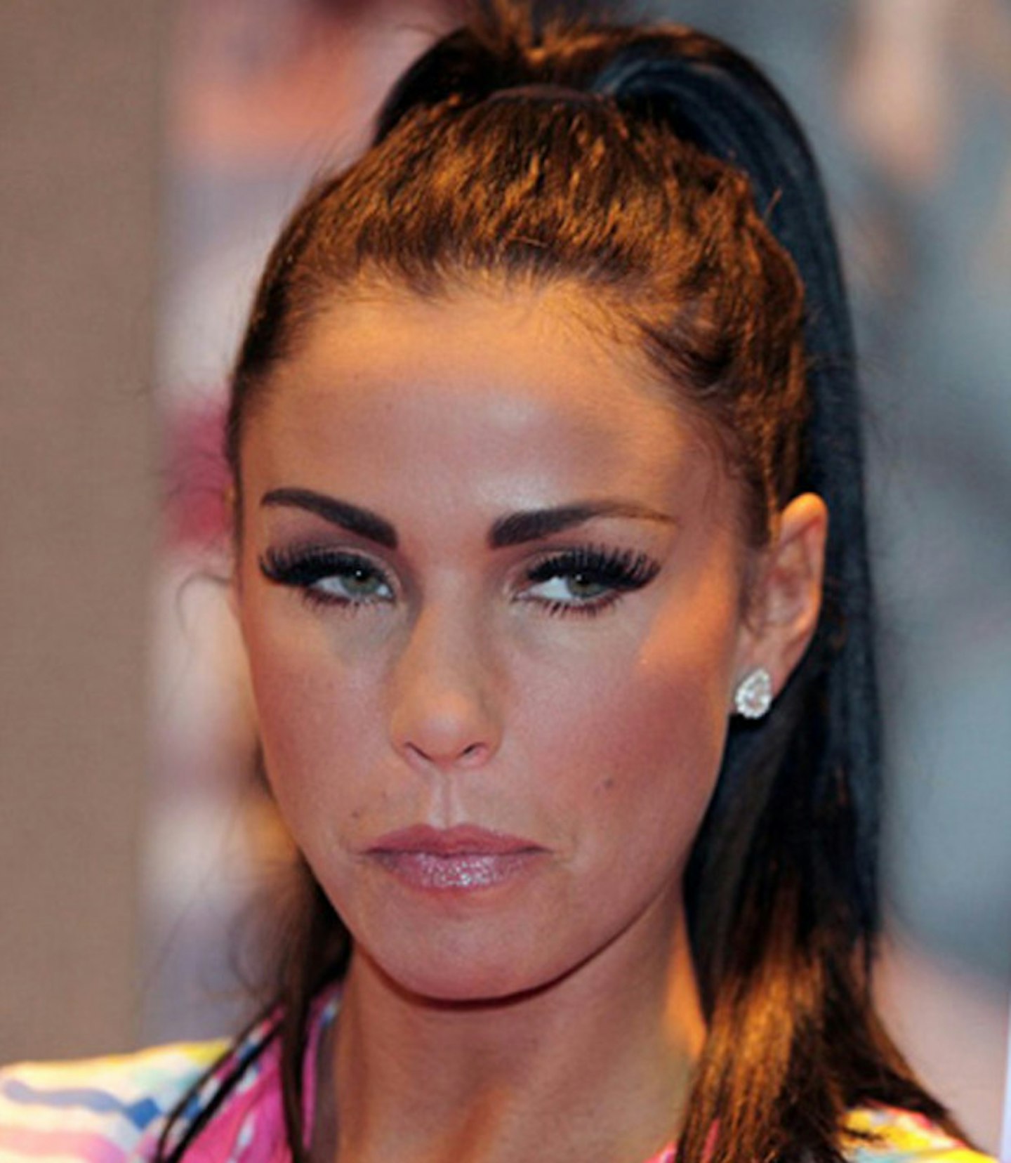 katie-price-jordan-cosmetic-plastic-surgery-before-and-after-46