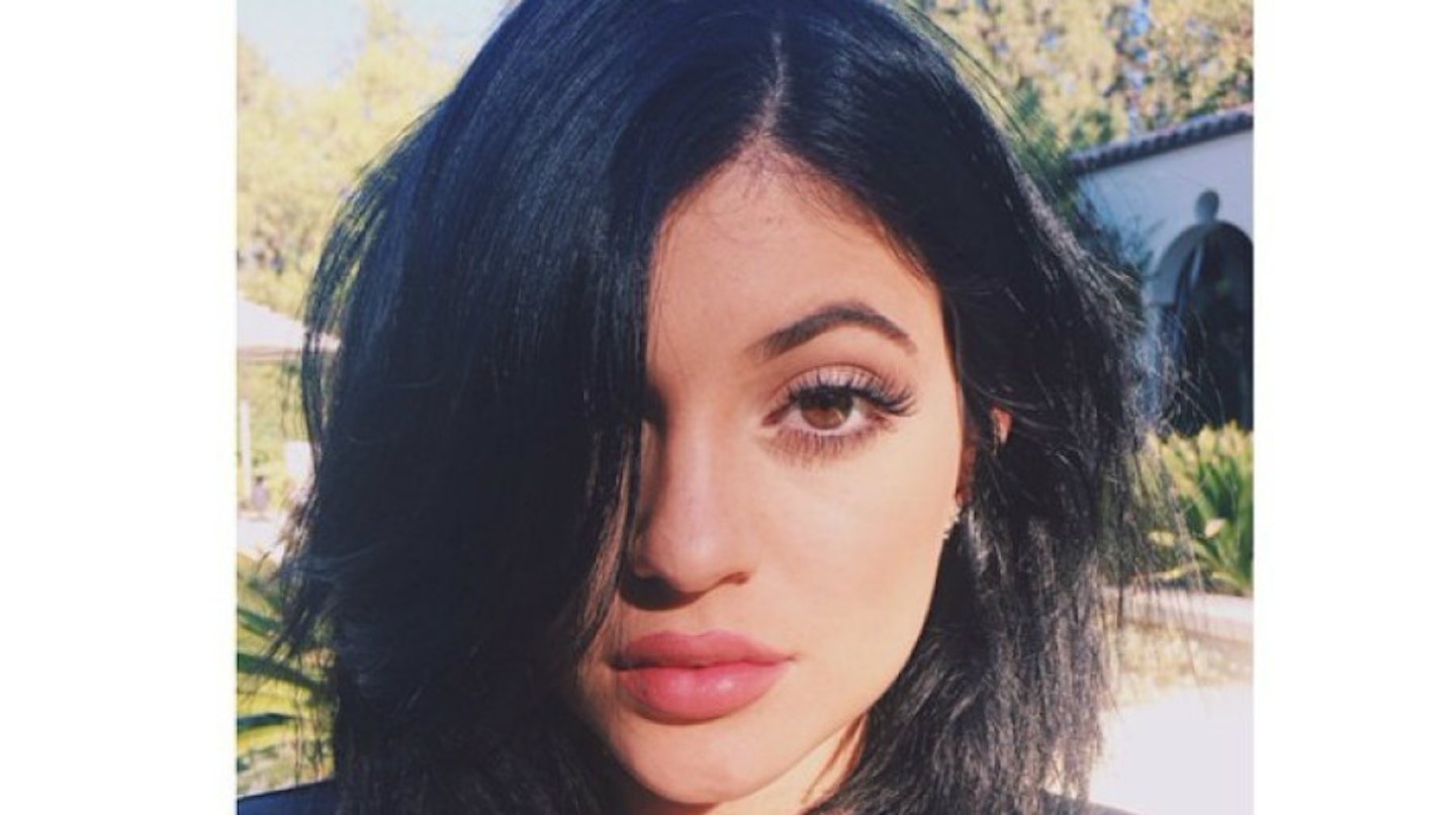 kylie-jenner-after-surgery7