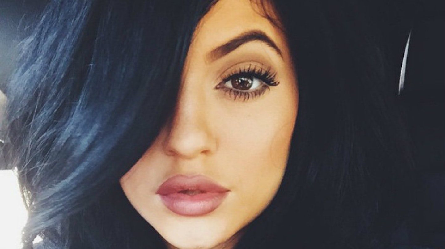 kylie-jenner-after-surgery1