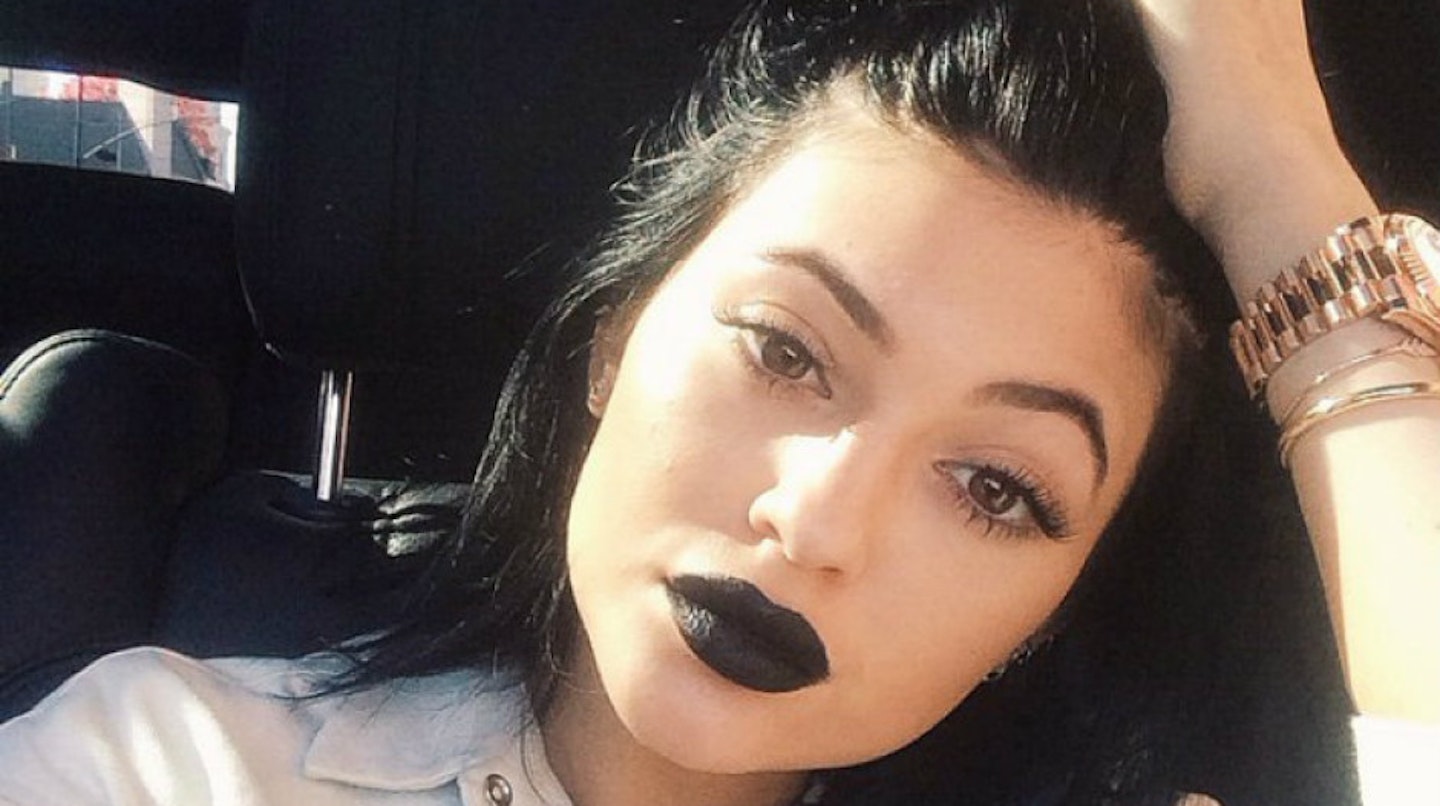 kylie-jenner-after-surgery5