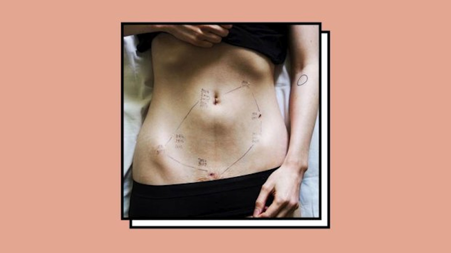 This Photographer Is Trying To Raise Awareness Of Endometriosis