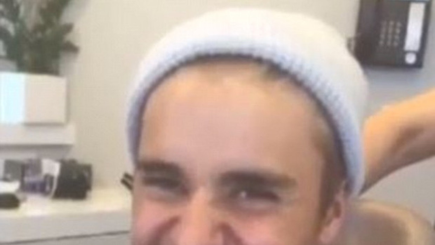 Watch Justin Bieber get his wisdom teeth removed | Celebrity