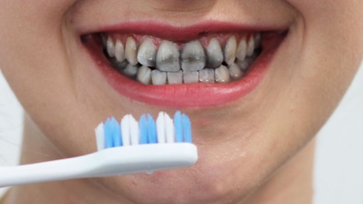 Review: Does Charcoal Teeth Whitening Toothpaste Actually Work?