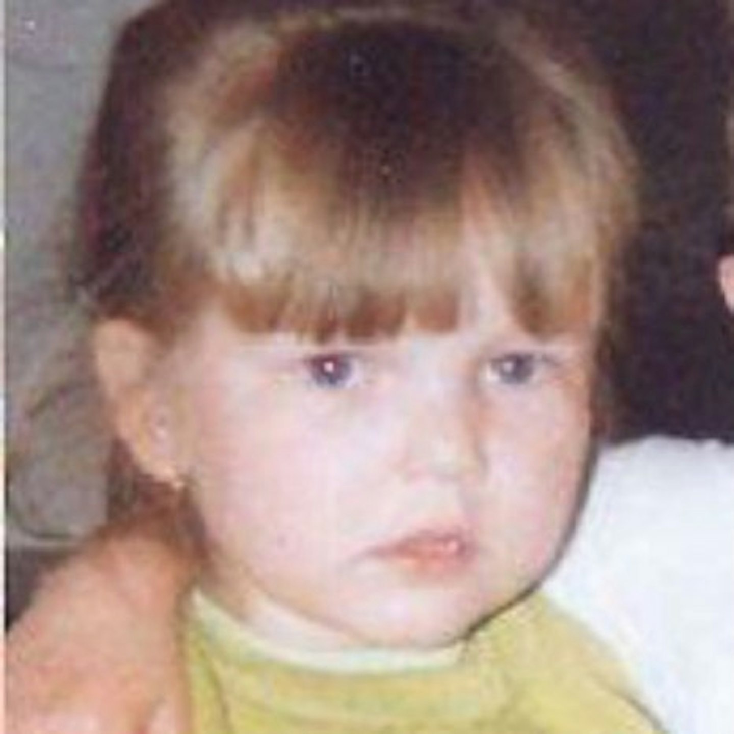 Mikaila, here aged three, only has 11% of liver function