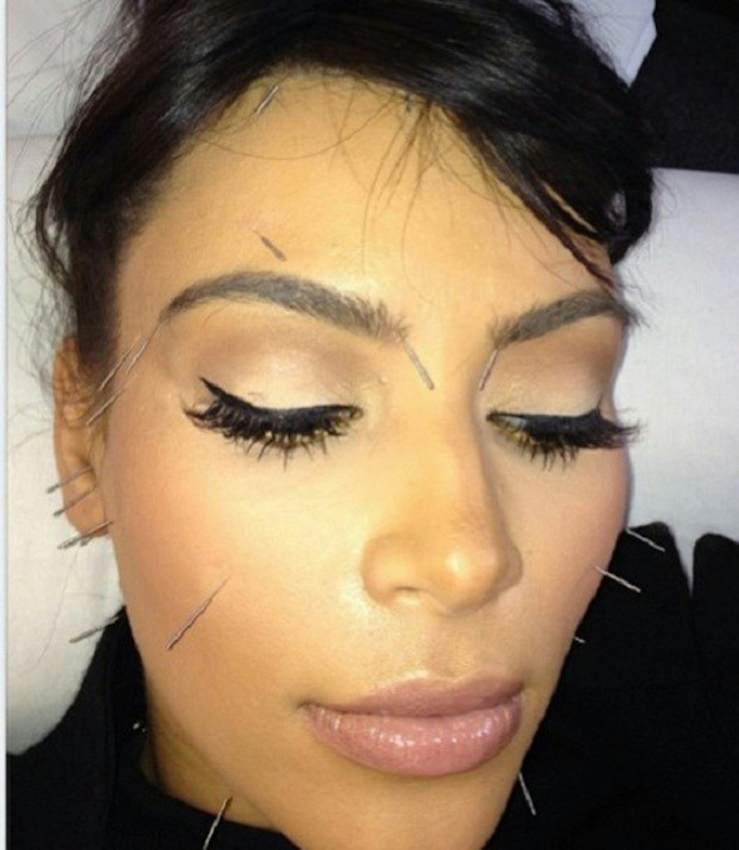 kim-kardashian-accupuncture-selfie-picture