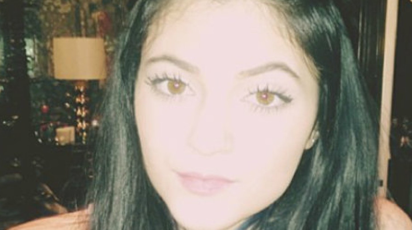 kylie-jenner-before-surgery2
