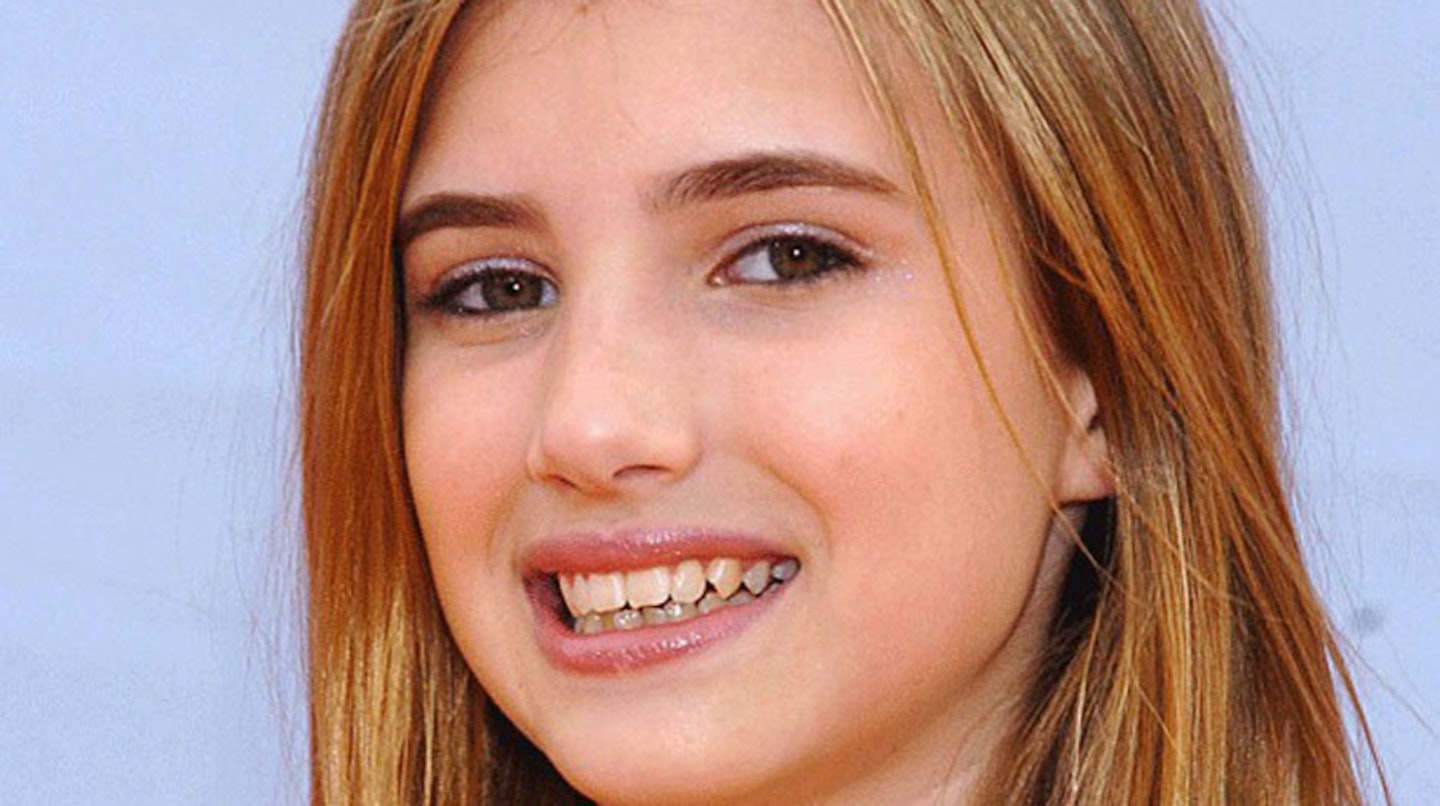 Emma-Roberts-actress-teeth-before