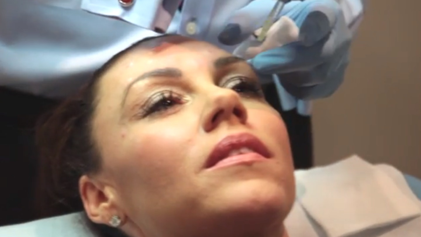 WATCH: Michelle Heaton shares graphic Botox video