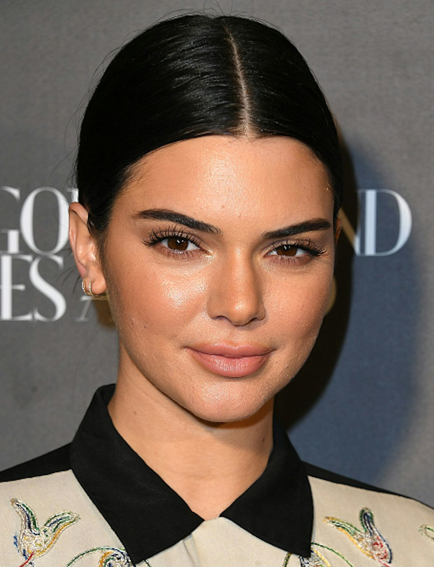 kendall-jenner-after-lips
