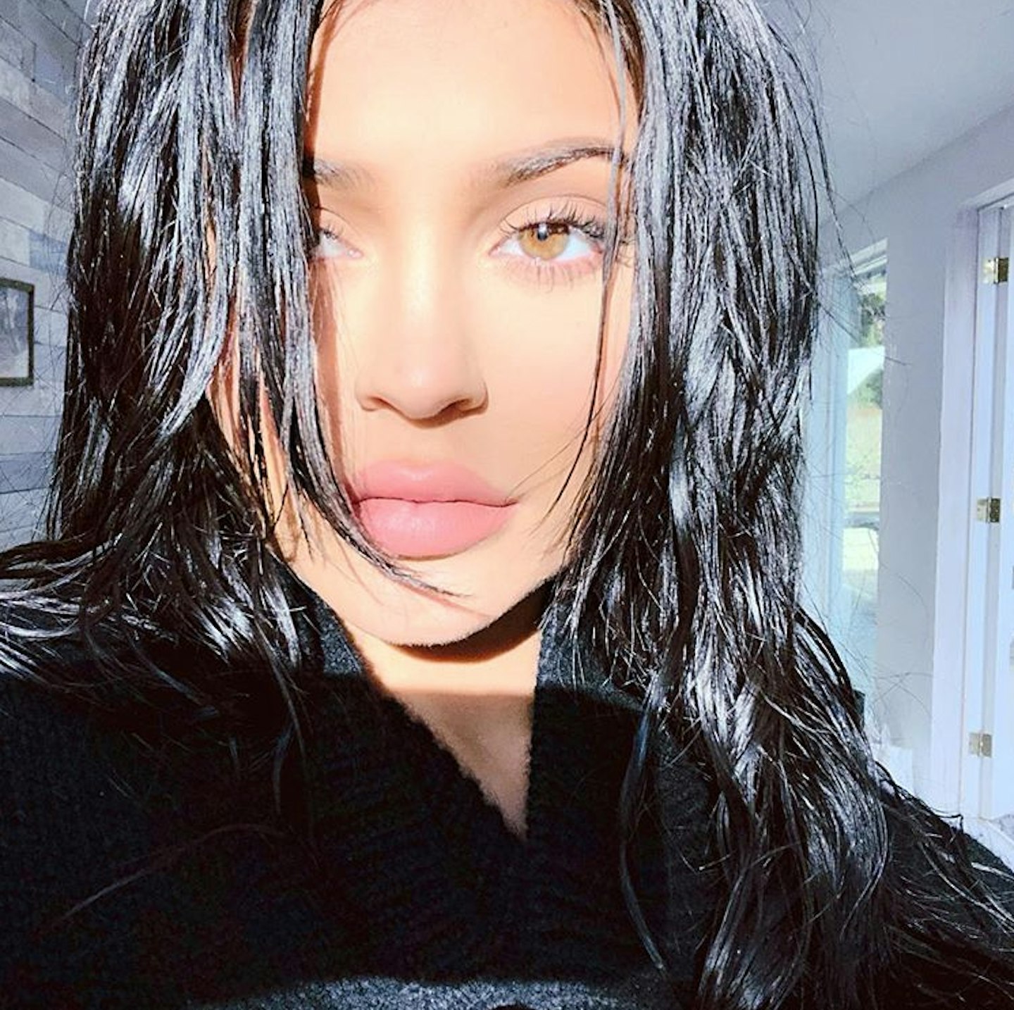 Kylie Jenner plastic surgery