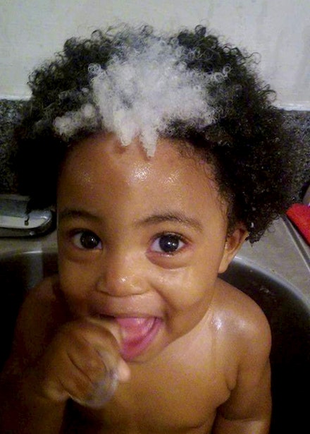 This baby's hair streak is actually a rare inherited 'birthmark' | Closer