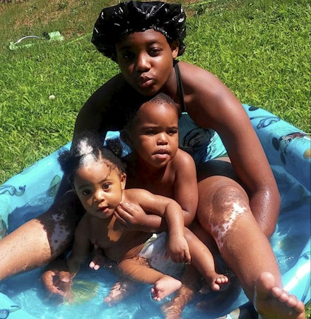 This baby's hair streak is actually a rare inherited 'birthmark' | Closer This baby's hair streak is actually a rare inherited 'birthmark' | Closer