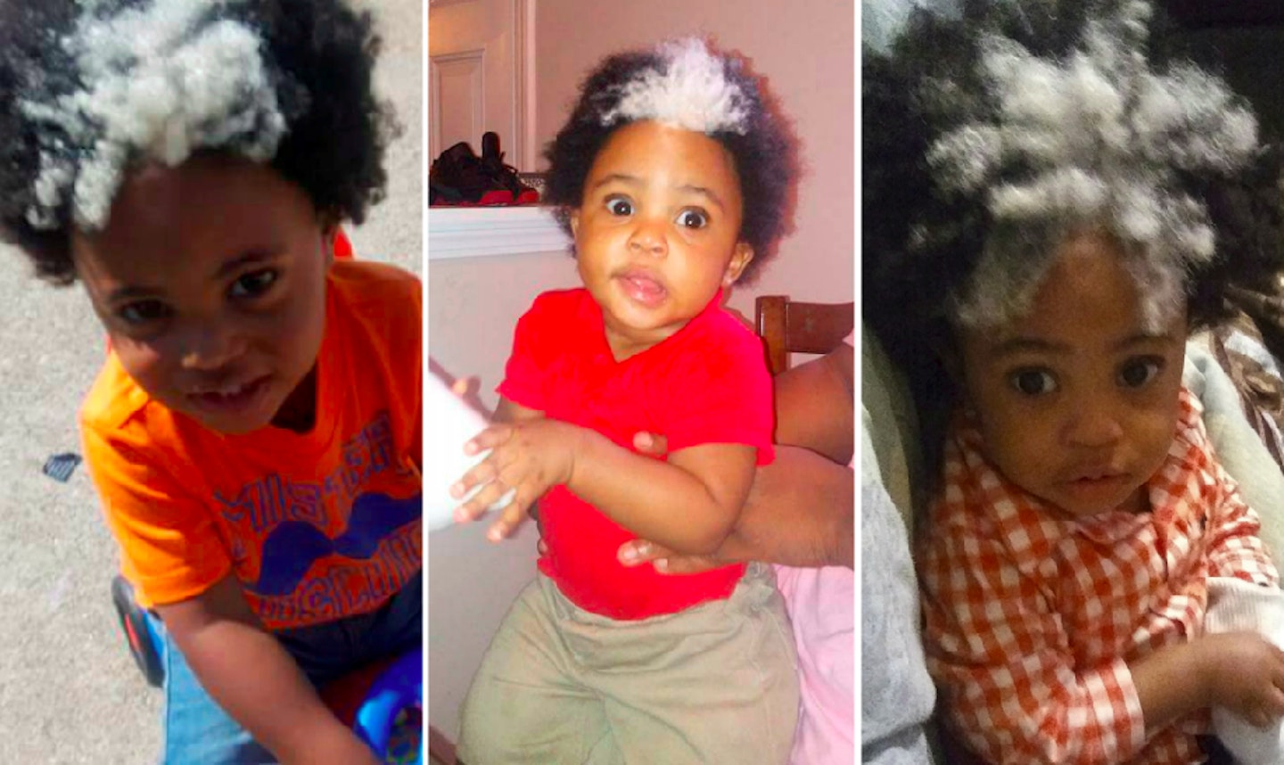 baby boy white hair streak birthmark genetics inherited josiah barnes family photos