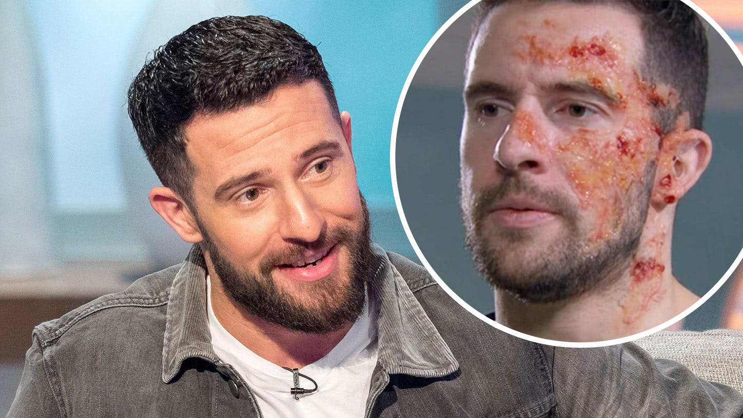 Emmerdale Spoilers: Michael Parr Opens Up About Ross Barton's Acid ...