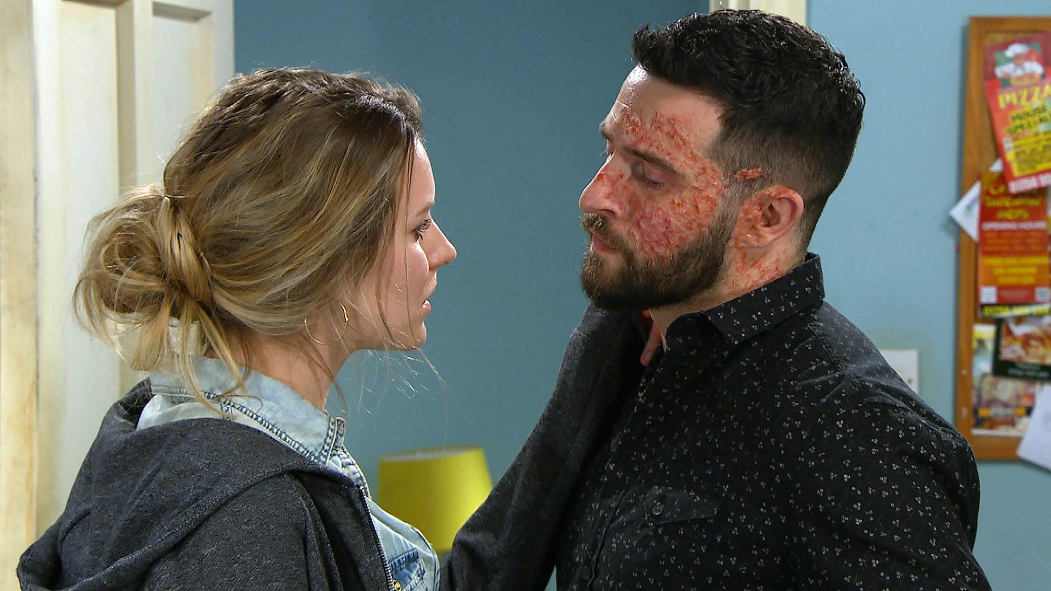 Emmerdale Spoilers: Debbie Dingle Confesses To Ross Barton Acid Attack ...