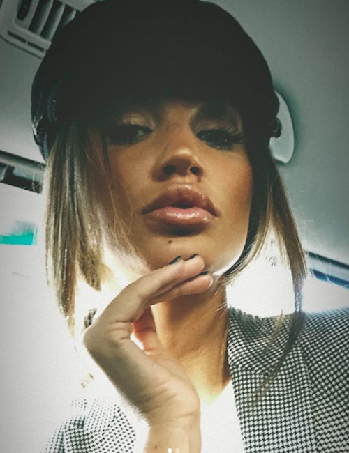 Love Island’s Olivia Attwood dissolves lip fillers after admitting she