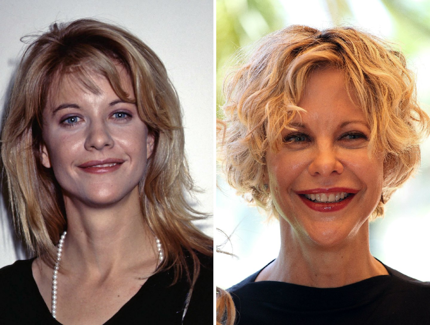 Meg Ryan before and after plastic surgery