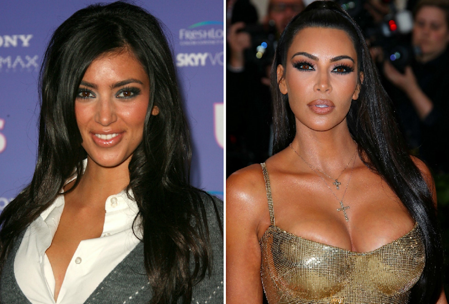 28 celebrities who look VERY different after plastic surgery