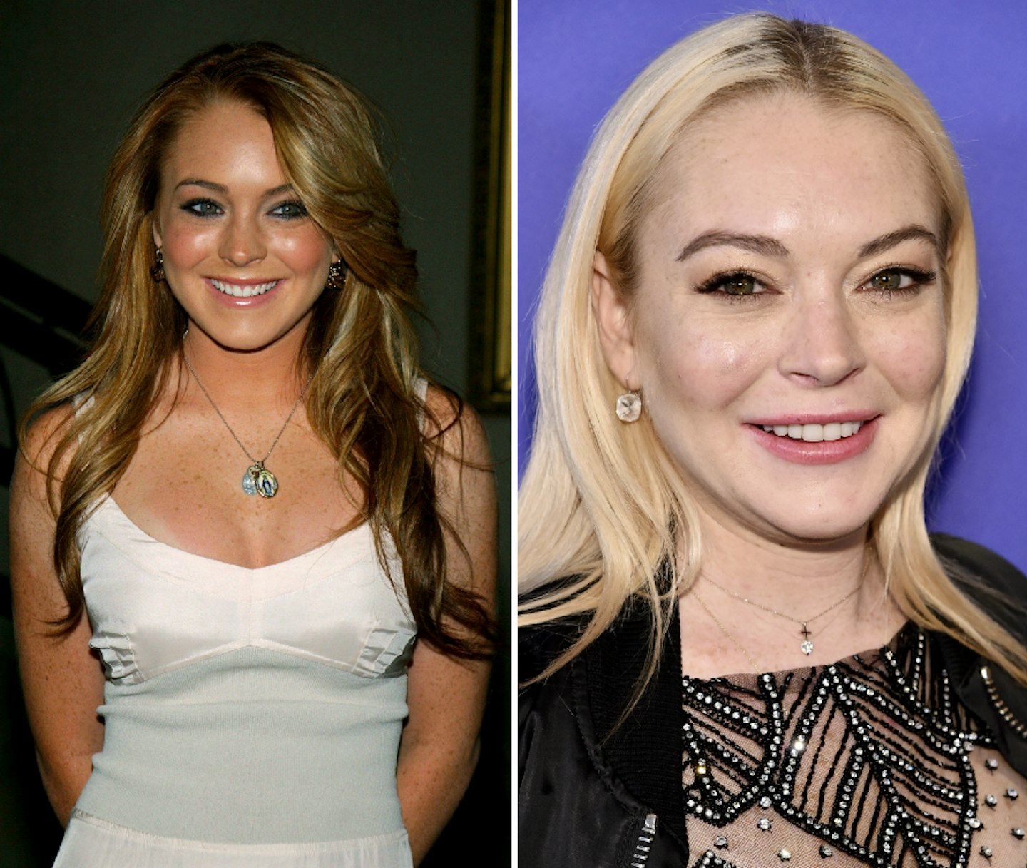 Lindsay Lohan before and after plastic surgery