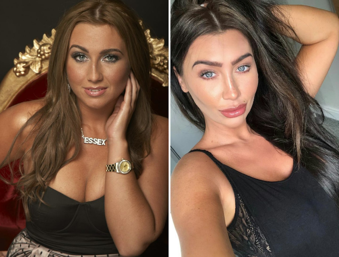 Lauren Goodger before and after plastic surgery