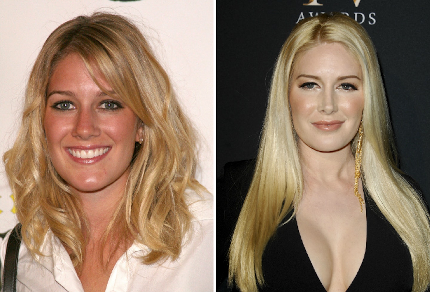 Heidi Montag before and after plastic surgery