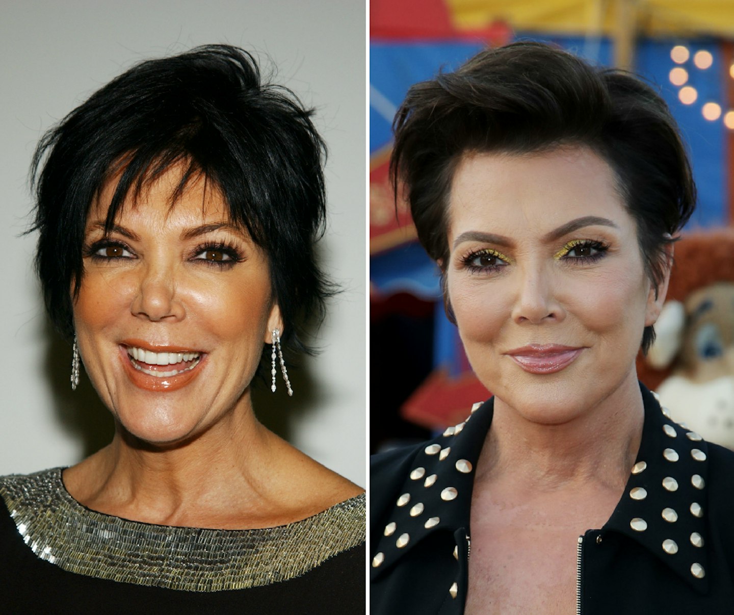 Kris Jenner before and after plastic surgery