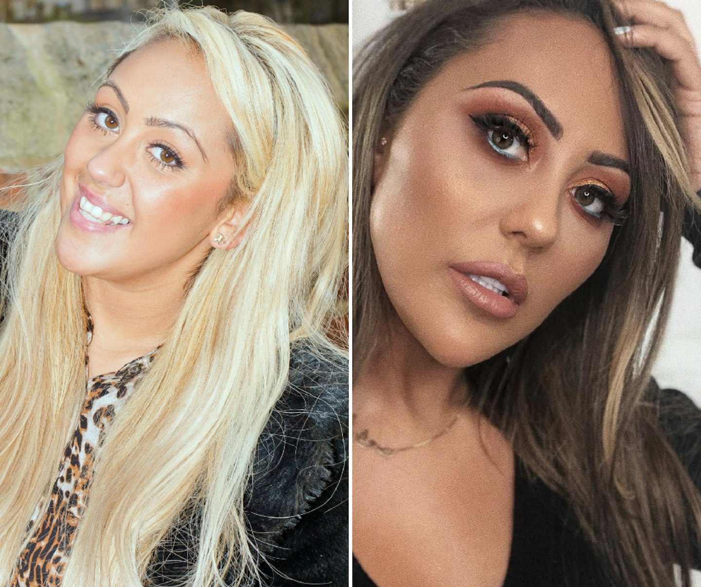Sophie Kasaei before and after plastic surgery