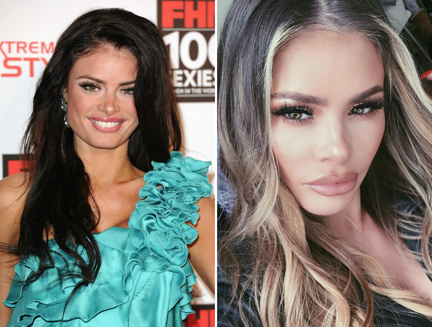 Chloe Sims before and after plastic surgery