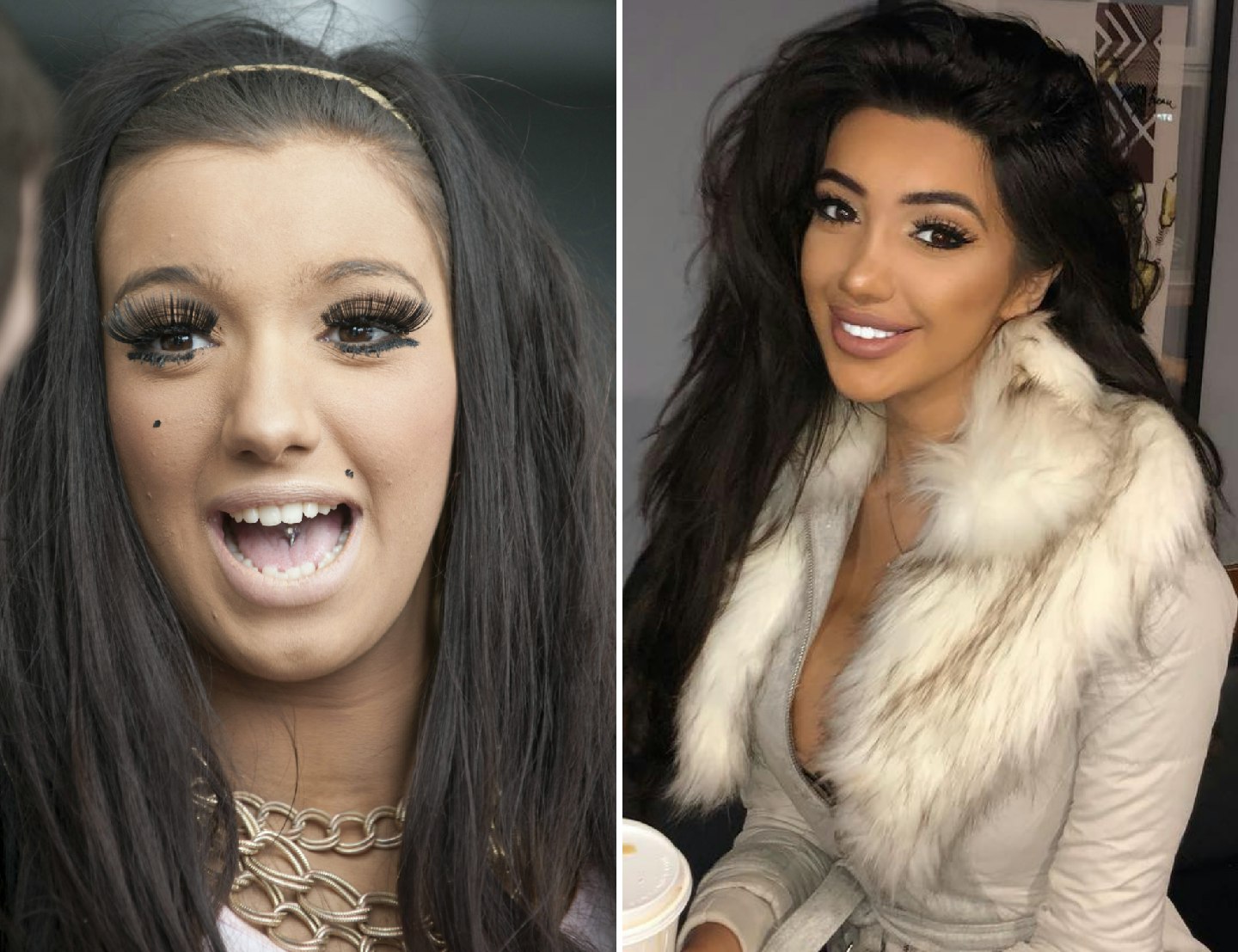 Chloe Khan before and after plastic surgery