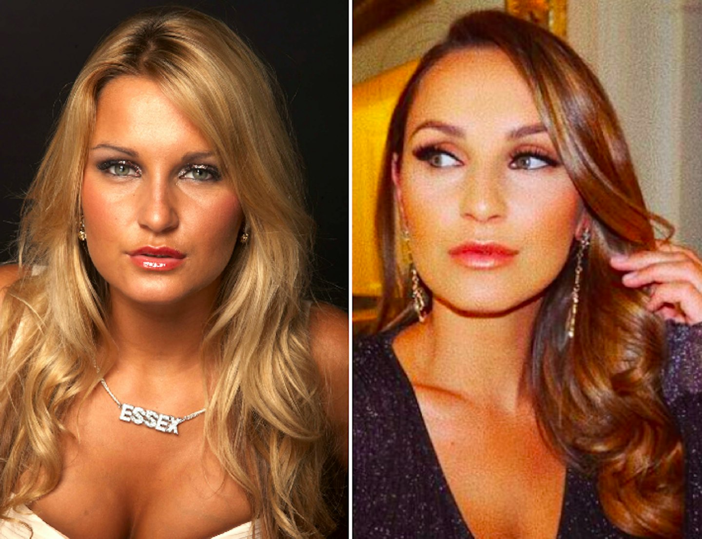 Sam Faiers before and after plastic surgery